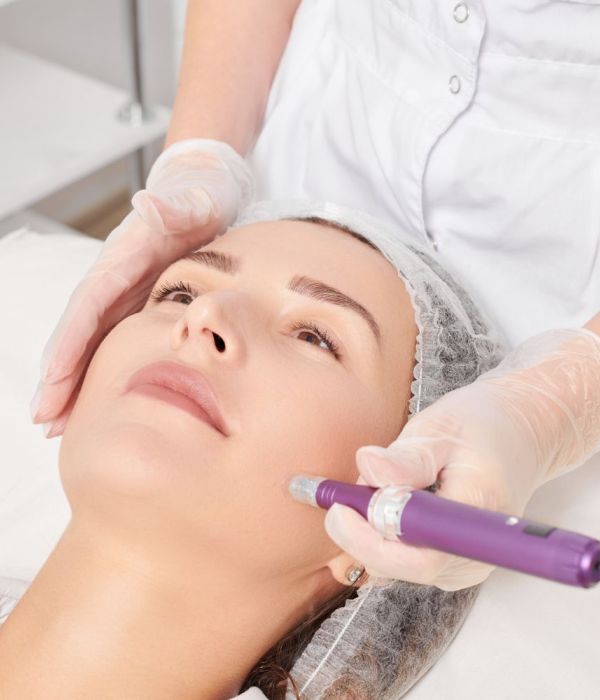 Microneedling Bergamo